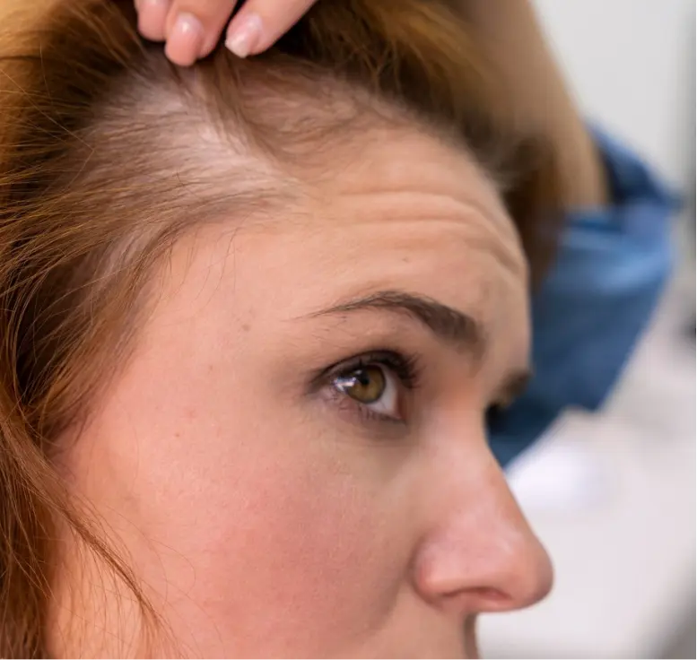 Tratamento Capilar de Crescimento